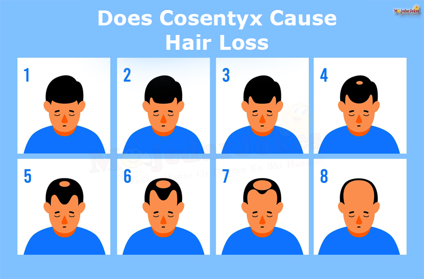 Cosentyx Side Effects : Does Cosentyx Cause Hair Loss