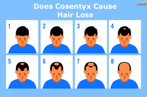 Cosentyx Side Effects : Does Cosentyx Cause Hair Loss